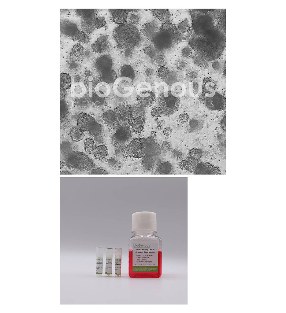 Small Cell Lung Cancer Organoid Kit小细胞肺癌