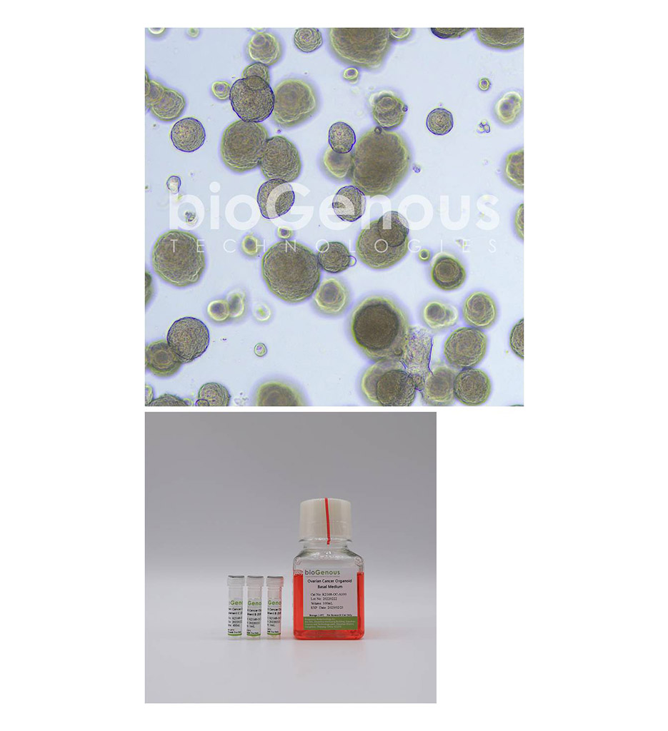 Ovarian Cancer Organoid Kit卵巢癌