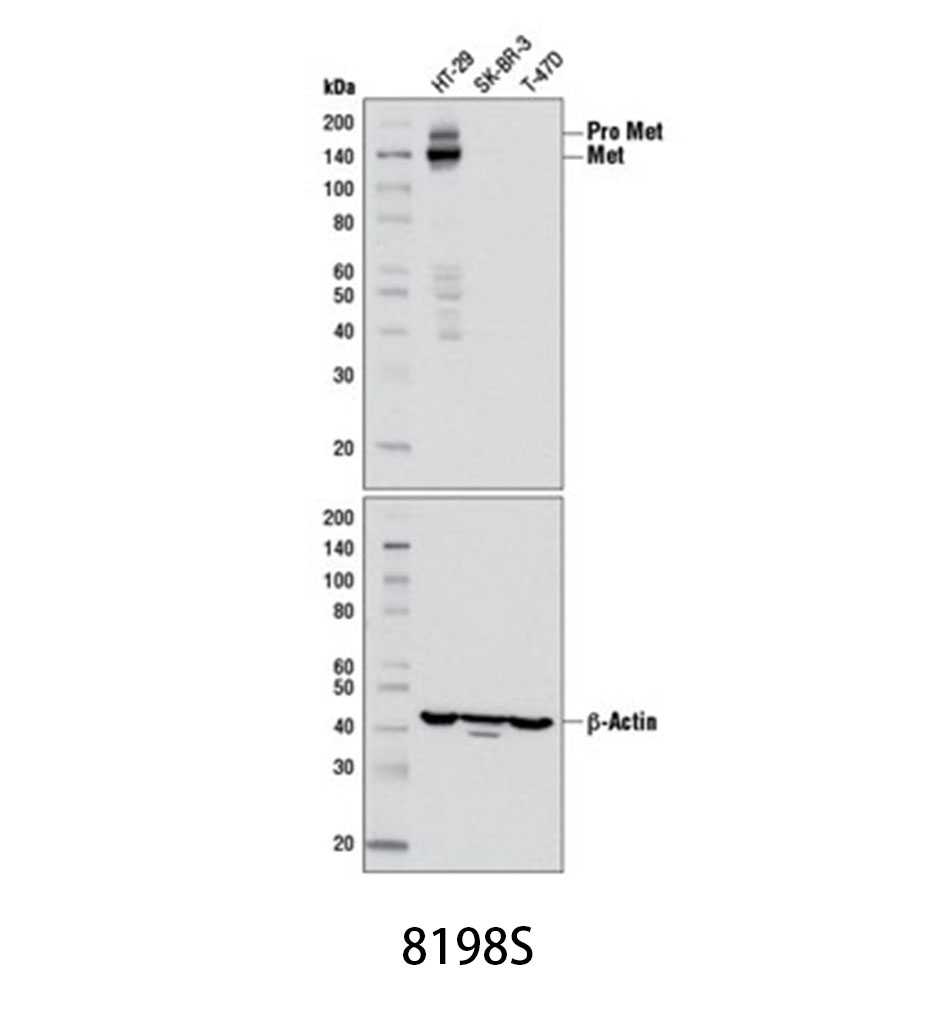Met (D1C2) XP Rabbit mAb