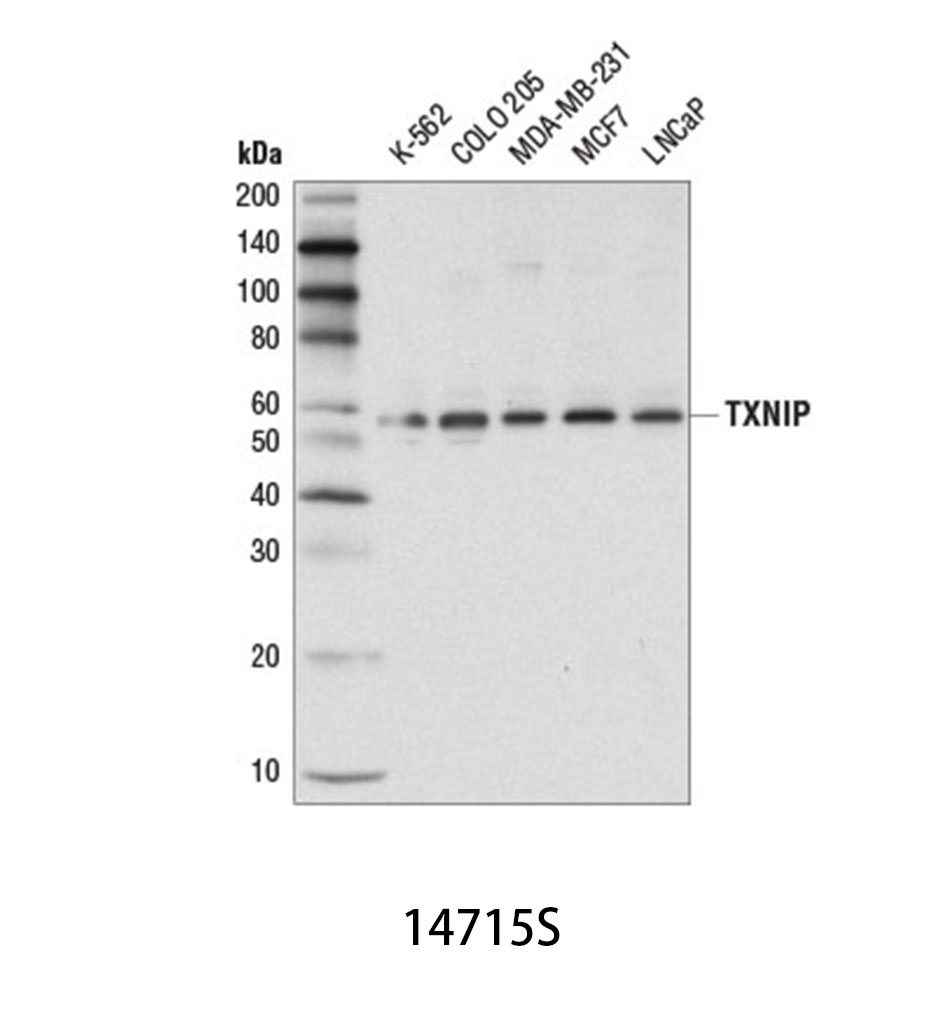 TXNIP (D5F3E) Rabbit mAb
