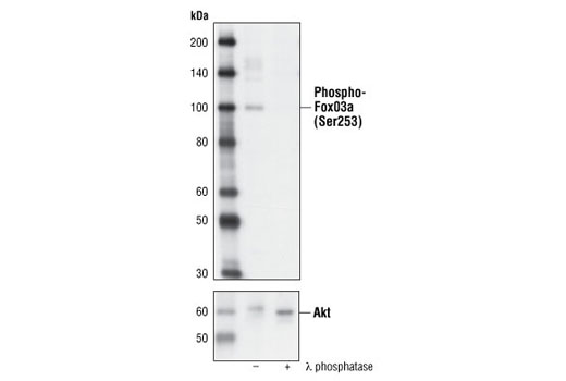Phospho-FoxO3a (Ser253) Antibody