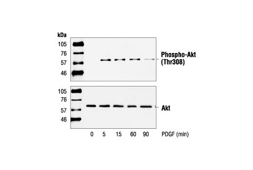 Phospho-Akt (Thr308) Antibody
