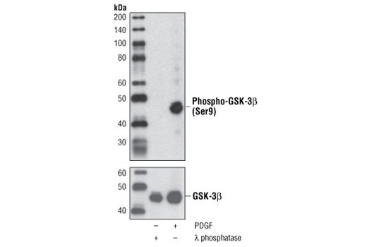 Phospho-GSK-3-beta (Ser9) (D3A4) Rabbit mAb