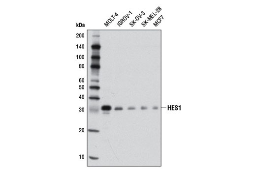 Notch Activated Targets Antibody Sampler Kit