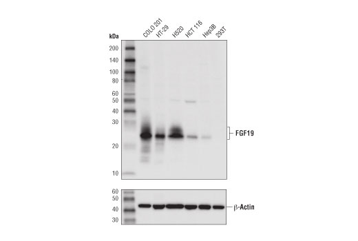 FGF19 (D1N3R) Rabbit mAb