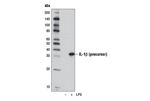 IL-1β (D3H1Z) Rabbit mAb (Mouse Specific)