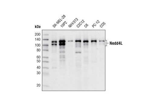 NEDD4L Antibody