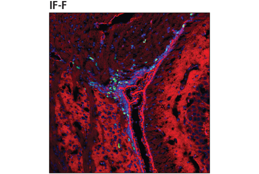 Ki-67 (D3B5) Rabbit mAb