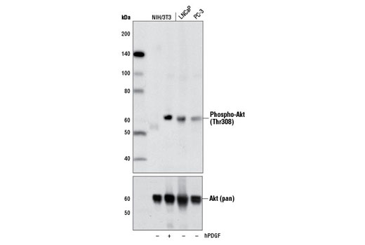 Insulin/IGF-1 Signaling Pathway Antibody Sampler Kit