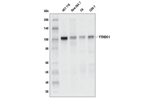 YTHDC1 (E4I9E) Rabbit mAb