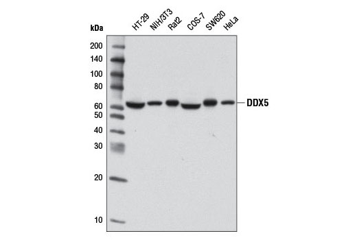 DDX5 (D15E10) XP Rabbit mAb