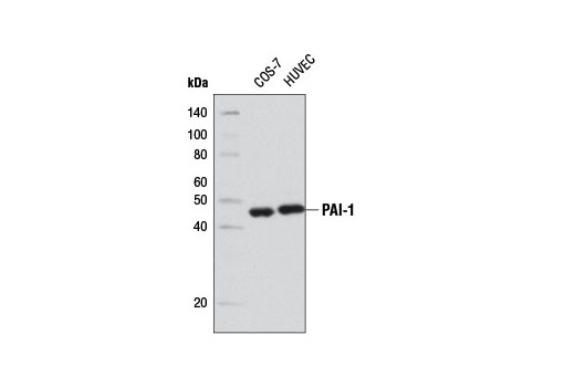 Senescence Associated Secretory Phenotype (SASP) Antibody Sampler Kit