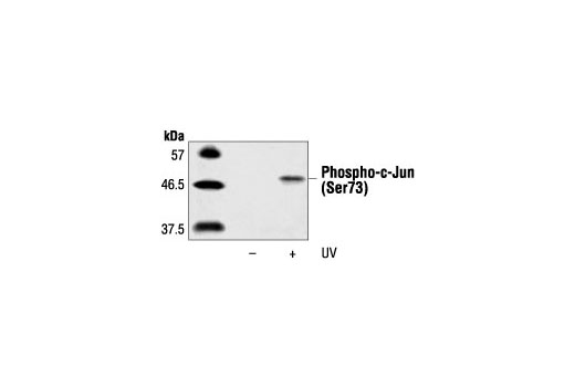 Phospho-c-Jun (Ser73) Antibody