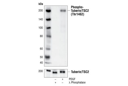 Phospho-Tuberin/TSC2 (Thr1462) (5B12) Rabbit mAb