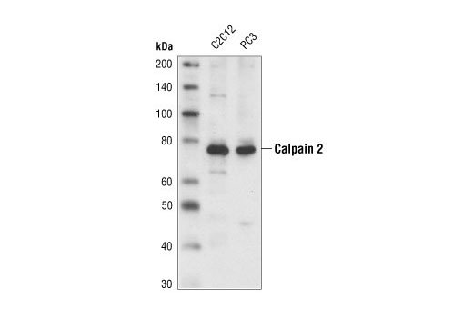 Calpain 2 Large Subunit (M-type) Antibody