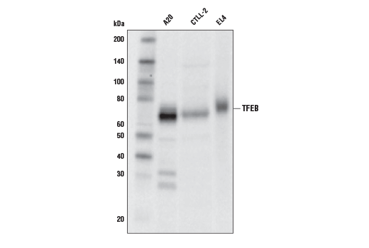 TFEB (D4L2P) Rabbit mAb