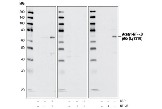 Acetyl-NF-κB p65 (Lys310) Antibody