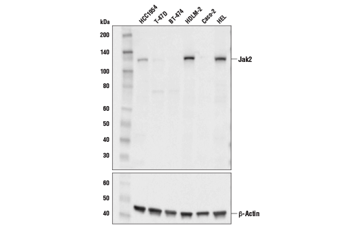 Jak2 (E4Y4D) Mouse mAb