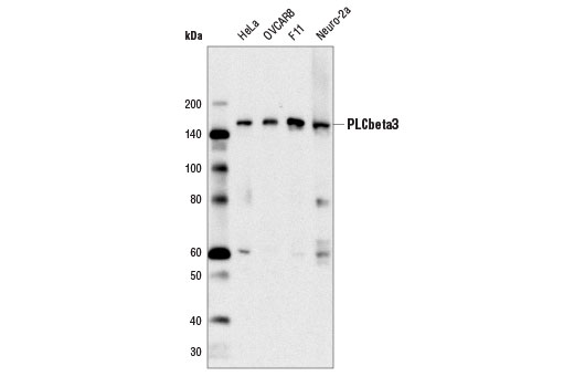 PLCbeta3 (D9D6S) Rabbit mAb