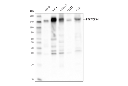 PTK7/CCK4 (D2Z1N) Rabbit mAb