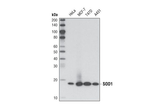 SOD1 (71G8) Mouse mAb