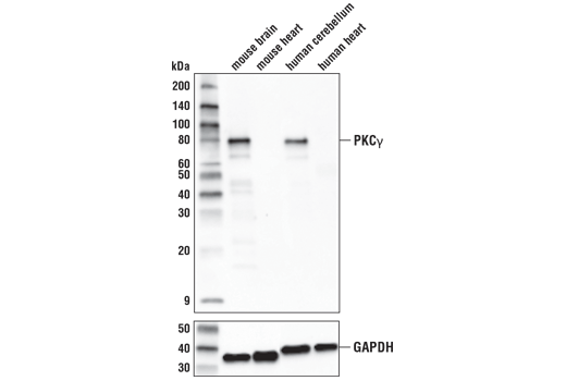 PKCγ (D2V6T) Rabbit mAb