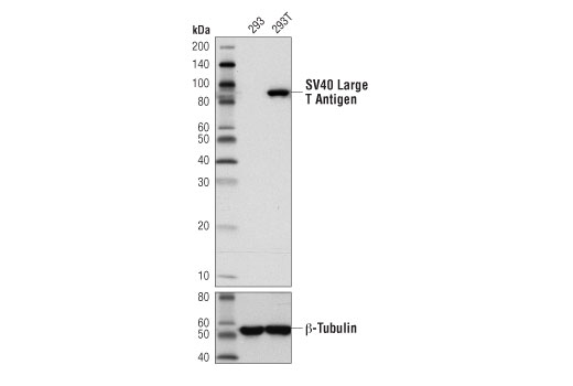 SV40 Large T Antigen (D1E9E) Rabbit mAb