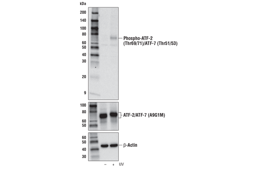 Phospho-ATF-2 (Thr69/71)/ATF-7 (Thr51/53) Antibody