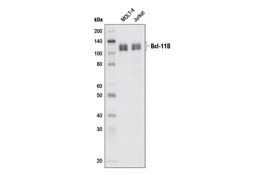 Bcl-11B (D6F1) XP Rabbit mAb