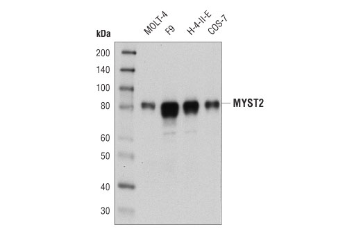 MYST2 (D4N3F) Rabbit mAb