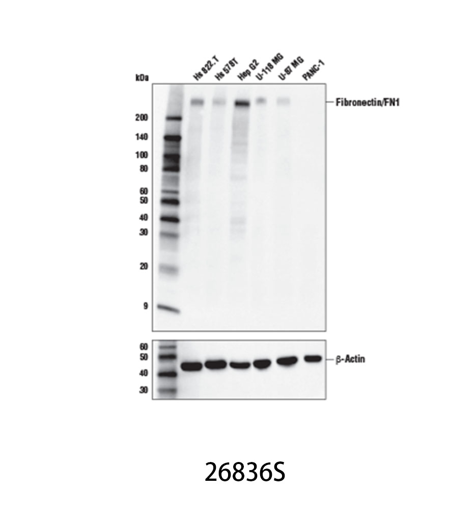 Fibronectin/FN1 (E5H6X) Rabbit mAb