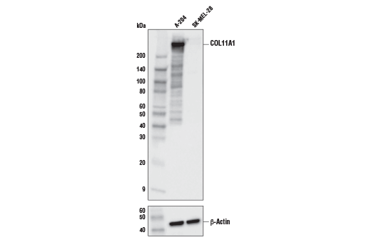 COL11A1 Antibody