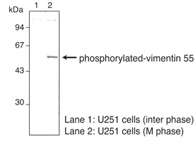 Anti-Phosphorylated Vimentin (Ser55) mAb
