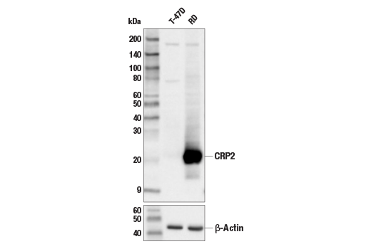 CRP2 (E8R5N) Rabbit Monoclonal Antibody