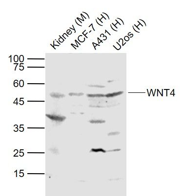 信号通路Wnt4抗体