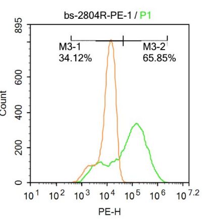 心肌特异性肌钙蛋白T抗体