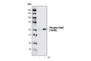 DNA Damage Antibody Sampler Kit