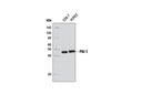 Senescence Associated Secretory Phenotype (SASP) Antibody Sampler Kit