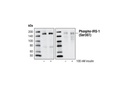 Insulin Receptor Substrate Antibody Sampler Kit