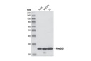 RhoGDI Antibody