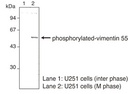 Anti-Phosphorylated Vimentin (Ser55) mAb