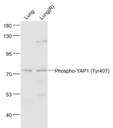 磷酸化原癌基因Yes相关蛋白1抗体