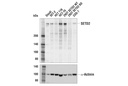 SETD2 (E4W8Q) Rabbit mAb